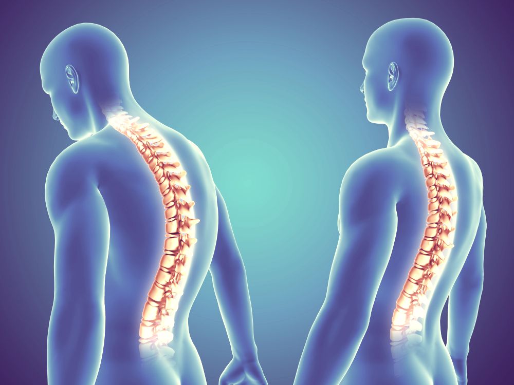 Spinal Conditions: Prevention and Treatment with Bone Growth Stimulators