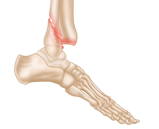 Ankle Conditions, Surgery, and Recovery