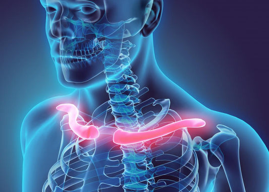 Collarbone Fracture