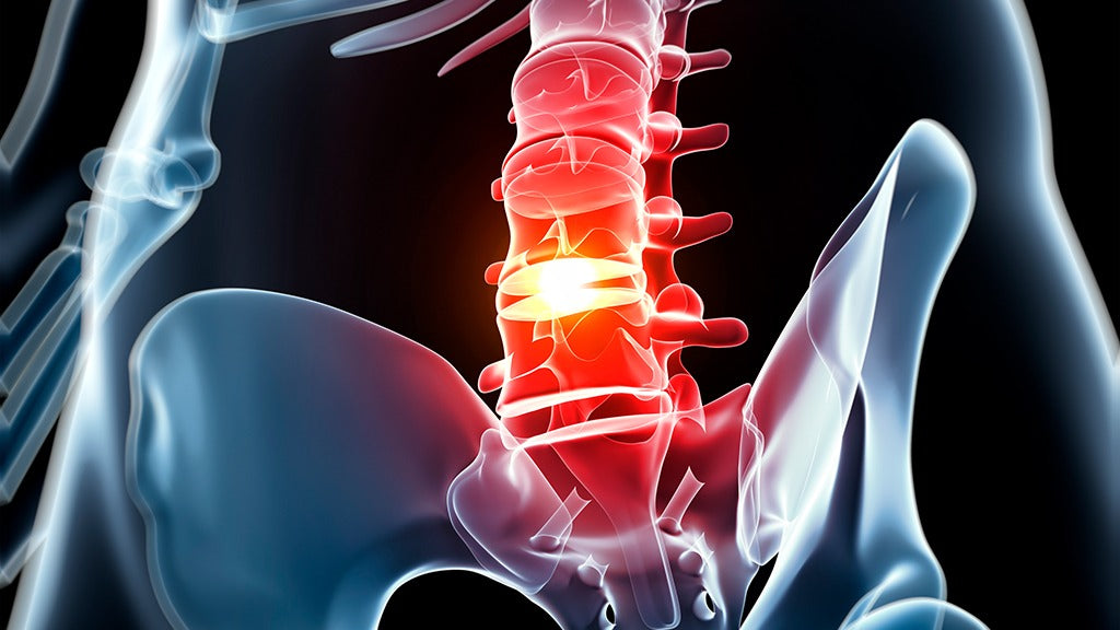 How to Manage Degenerative Disc Disease Pain – Daphco Bone Stims