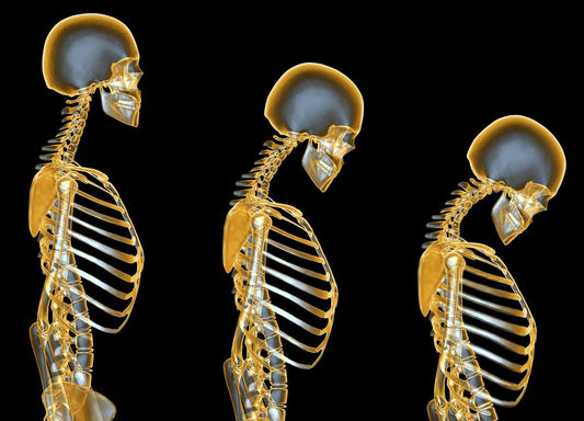 How Bone Growth Stimulators Aid Those Battling Osteoporosis