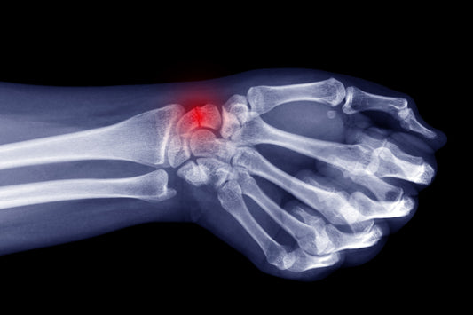 Wrist Fracture: Conditions, Symptoms, Treatment and Prevention